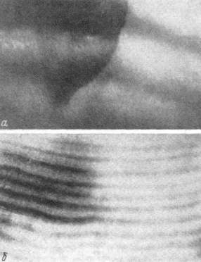 Участок поперечного шлифа дентина зуба кашалота (а)   и цемента клыка хохлача (б)